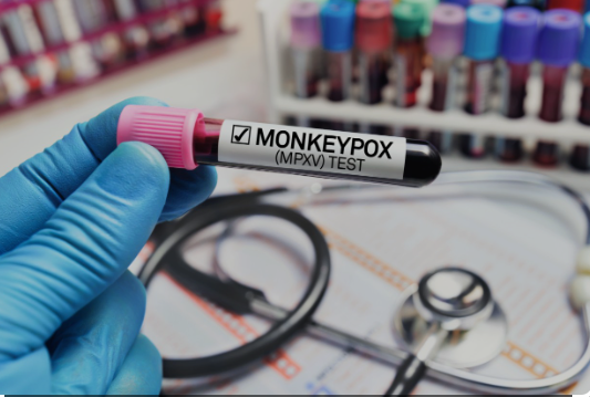 Thailand Waspada Deteksi 787 Kasus Cacar Monyet Sejak 2022